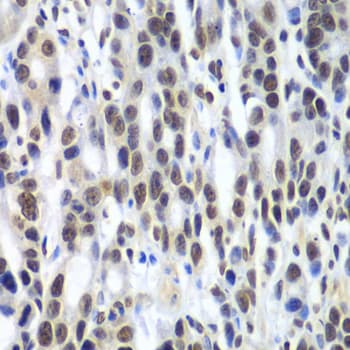 Polyclonal Rabbit anti-Human DDX1 Antibody (IHC, IF, WB)
