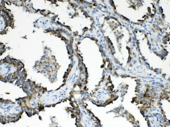 Polyclonal Rabbit anti-Human HSD17B4 Antibody (IHC, WB)