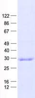 Human CCNB1IP1 Protein (Recombinant His, N-Terminal)