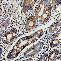TERE1 / UBIAD1 Antibody