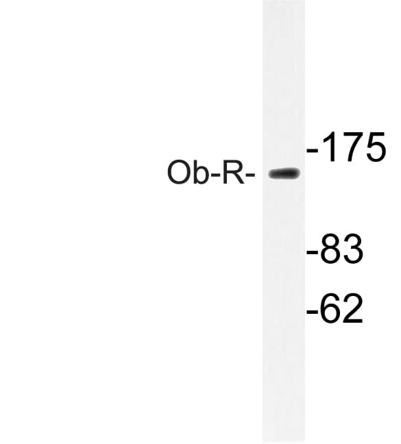 LEPR / Leptin Receptor Antibody (Leu662)
