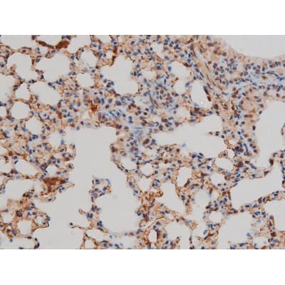 Polyclonal Rabbit anti-Human FLNA / Filamin A Antibody (phospho-Ser2152, IHC, IF, WB)