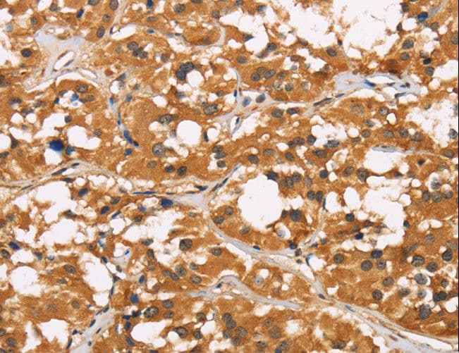Polyclonal Rabbit anti-Human CD22 Antibody (IHC)