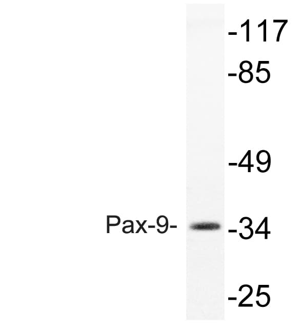 PAX9 Antibody (aa158-207)