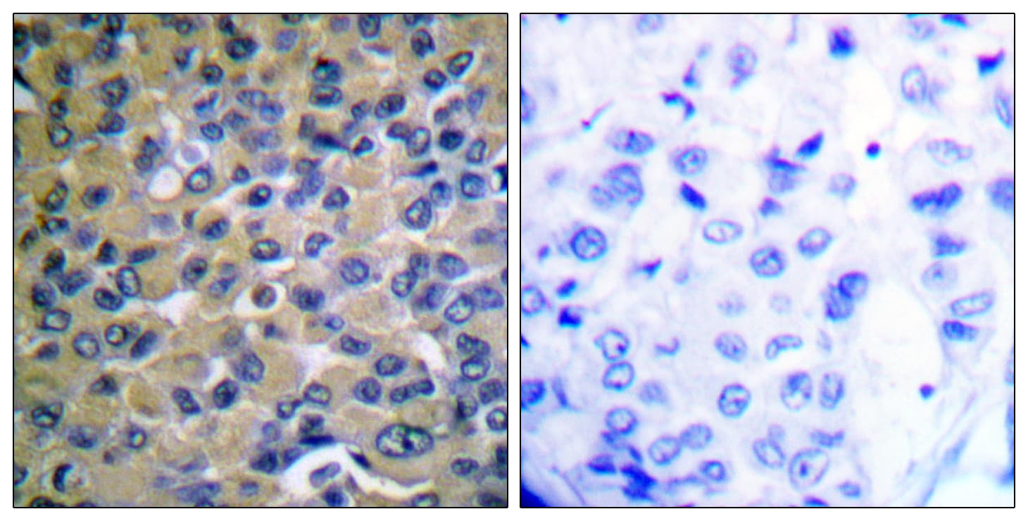 NFKBIE / IKB Epsilon Antibody (phospho-Ser22)