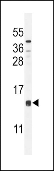 CCDC126 Antibody (aa77-106)