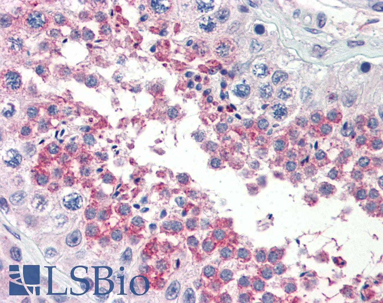 TSKS Antibody (N-Terminus)