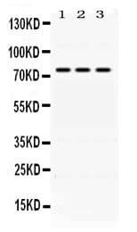 Polyclonal Rabbit anti-Human FACL2 / ACSL1 Antibody (IHC, WB)