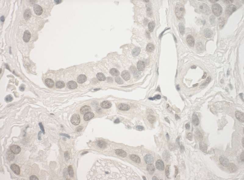 GSG2 / HASPIN Antibody (aa300-350)