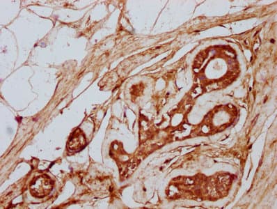 TTLL3 Antibody