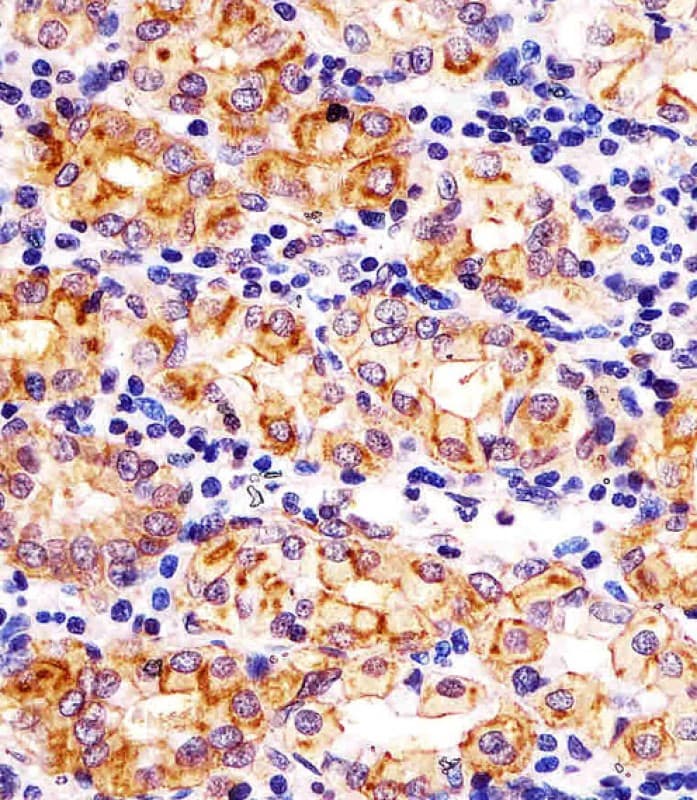 SLC22A2 Antibody (aa57-89)