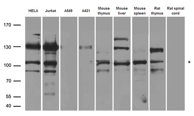 Polyclonal Rabbit anti-Human INCENP Antibody (WB)