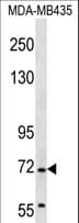 GRHL2 Antibody (aa409-438)