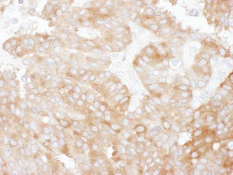 SLC9A3R1 / NHERF1 / EBP50 Antibody (aa275-325)