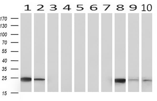 Monoclonal Mouse anti-Human CD3E Antibody (clone UMAB54, Carrier-free, IHC, IF, WB)