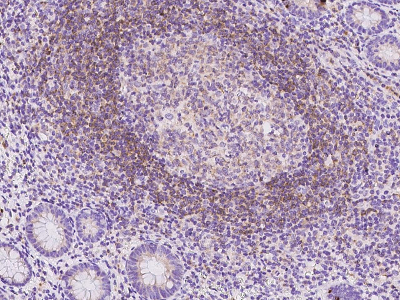Polyclonal Rabbit anti-Human PTPN6 / SHP1 Antibody (IHC, WB)