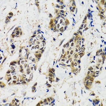 MAPK9 / JNK2 Antibody