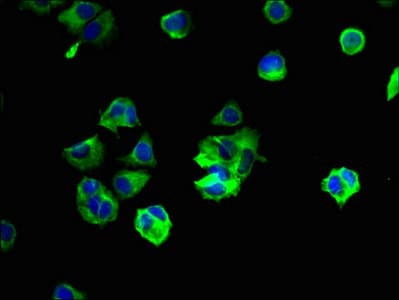 Polyclonal Rabbit anti-Human YIPF6 Antibody