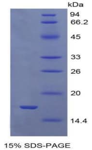 Human GDF9 / GDF-9 Protein (Recombinant His)