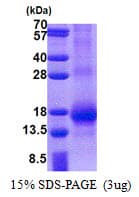 Human RNF7 Protein (Recombinant His)