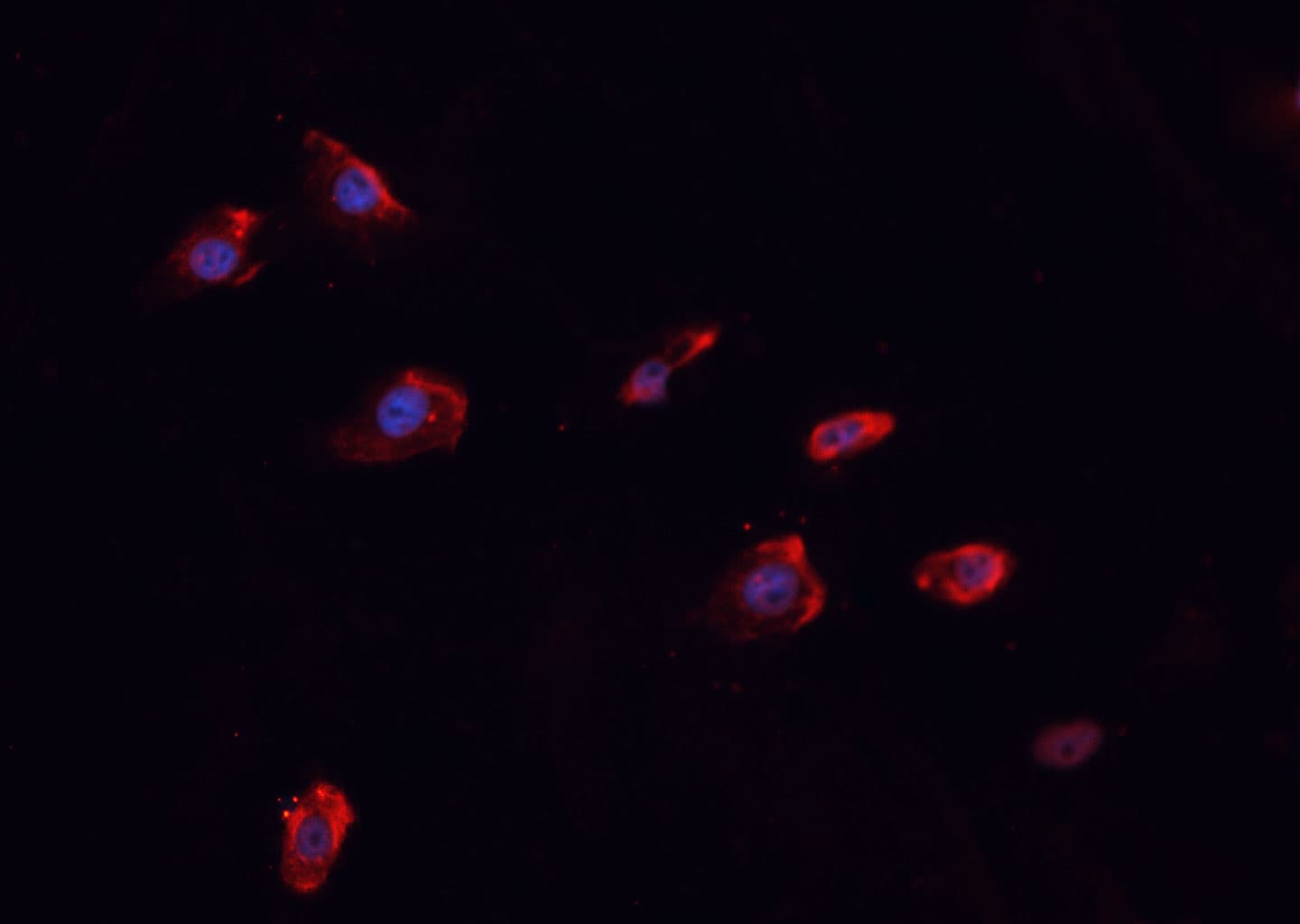 Polyclonal Rabbit anti-Human EMA / MUC1 Antibody (phospho-Tyr1229, IHC, IF, WB)