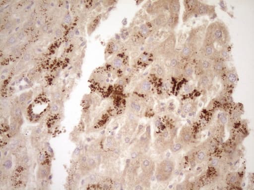 TFPI / LACI Antibody (aa29-304, clone OTI4H9, Carrier-free)