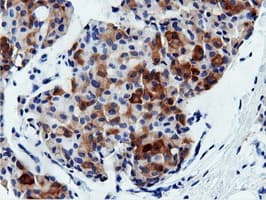 AK5 / Adenylate Kinase 5 Antibody (clone OTI2G4)