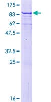 Human MAGEB6 Protein (Recombinant GST)