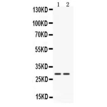 CTSG / Cathepsin G Antibody (aa21-261)