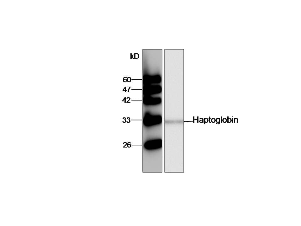 PathPlus™ HP / Haptoglobin Antibody (aa19-406)