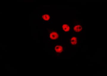 SFSWAP / SWAP Antibody