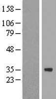 HZF16 / ZNF124 Protein (Over-Expression Lysate Myc-DDK (Flag))