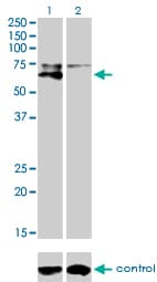 ALPL / Alkaline Phosphatase Antibody (clone 4H1)