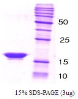 Human SNCB / Beta-Synuclein Protein (Recombinant)