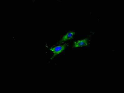 APP / Beta Amyloid Precursor Antibody (aa18-249)