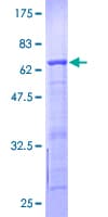 Human BCCIP Protein (Recombinant GST)
