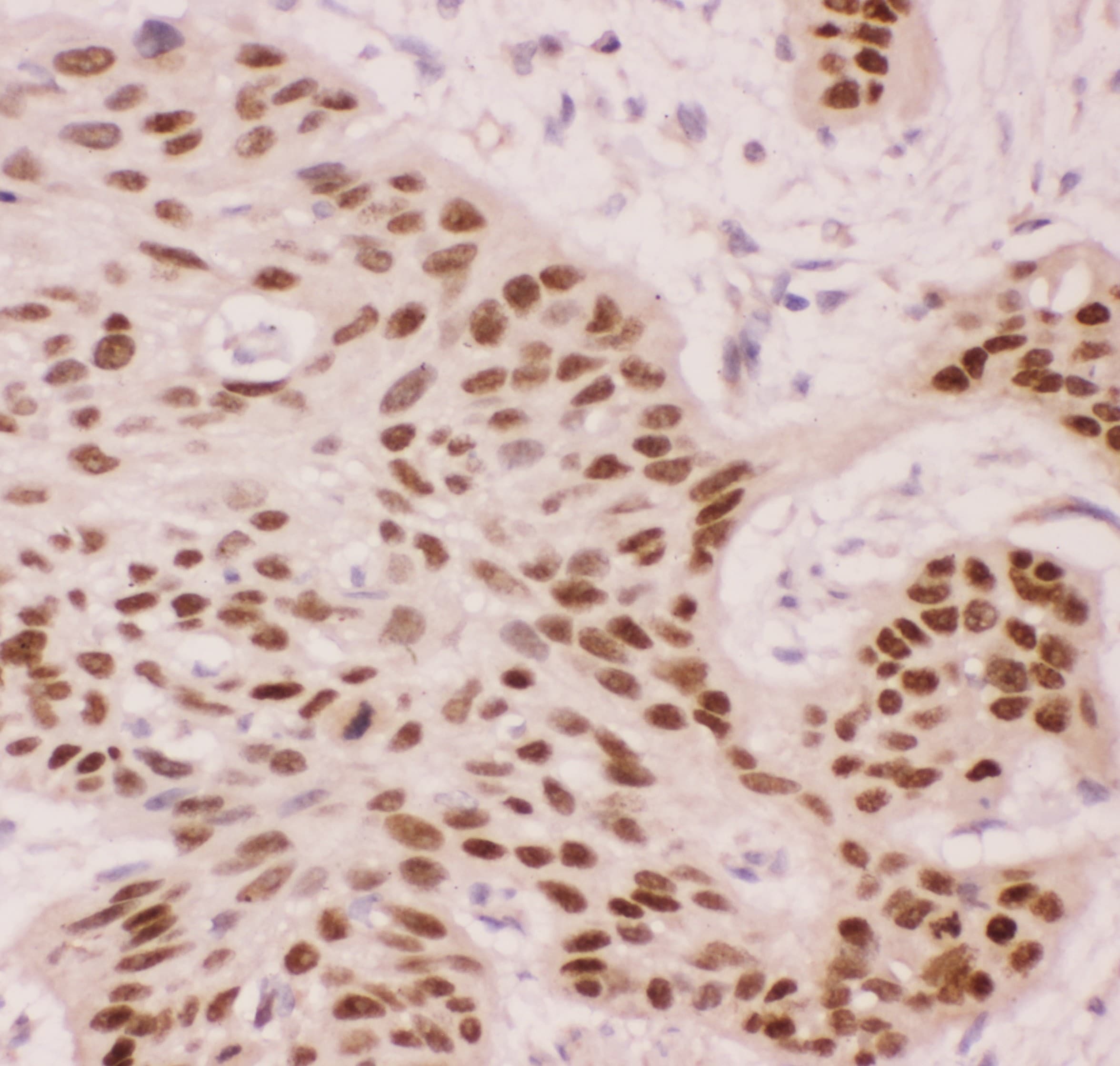 Polyclonal Rabbit anti-Human TP63 / p63 Antibody (aa311-680, IHC, WB)