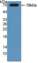 ADK / Adenosine Kinase Antibody (aa1-361)