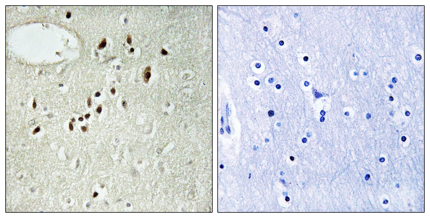 EMX2 Antibody (aa91-140)