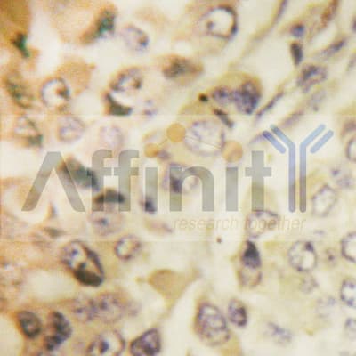 YWHAZ / 14-3-3 Zeta Antibody