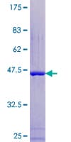 Human RBP1 / CRBP Protein (Recombinant GST)