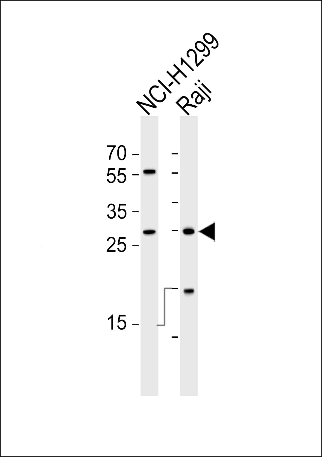 Polyclonal Rabbit anti-Human HLA-DRB1 Antibody (aa30-58, IHC, WB)