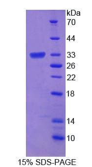 Mouse ROM1 Protein (Recombinant His, N-Terminal)