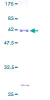 Human MRPL15 Protein (Recombinant GST)