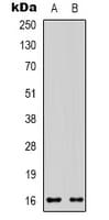 Polyclonal Rabbit anti-Human GYPA / CD235a / Glycophorin A Antibody (Internal, IHC, WB)
