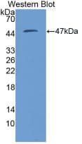 KNG1 / Kininogen / Bradykinin Antibody (aa22-379)