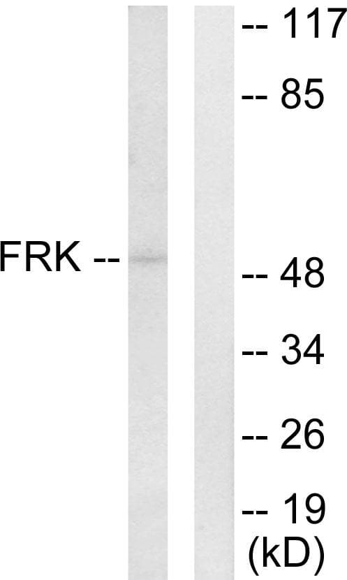 FRK Antibody