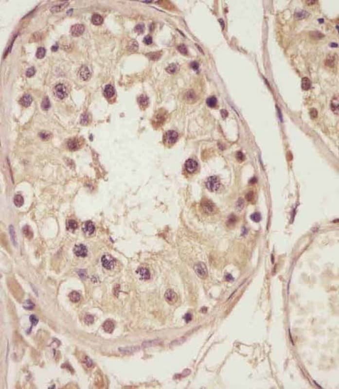 NSFL1C Antibody (Internal)