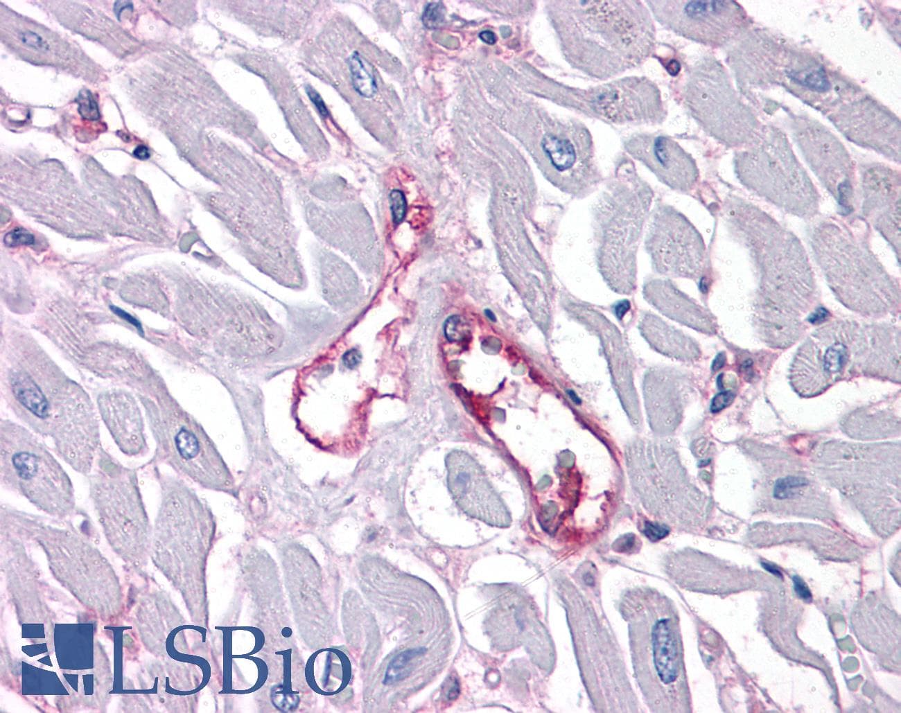 IHC-plus™ Monoclonal Mouse anti-Human ITGA5/Integrin Alpha 5/CD49e Antibody (clone 10F6, IHC, WB)