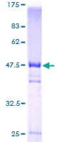 Human VBP1 Protein (Recombinant GST)
